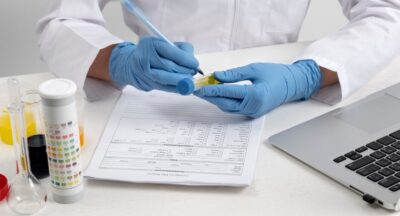 Do Shrooms Appear on Standard Drug Tests? Explained
