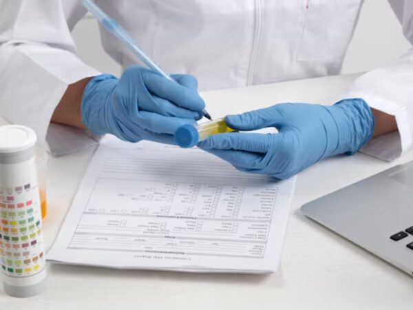 How to Dispute a False Positive DOT Drug Test Result